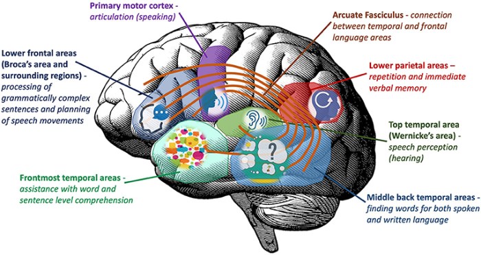 Unable to understand written words not aphasia