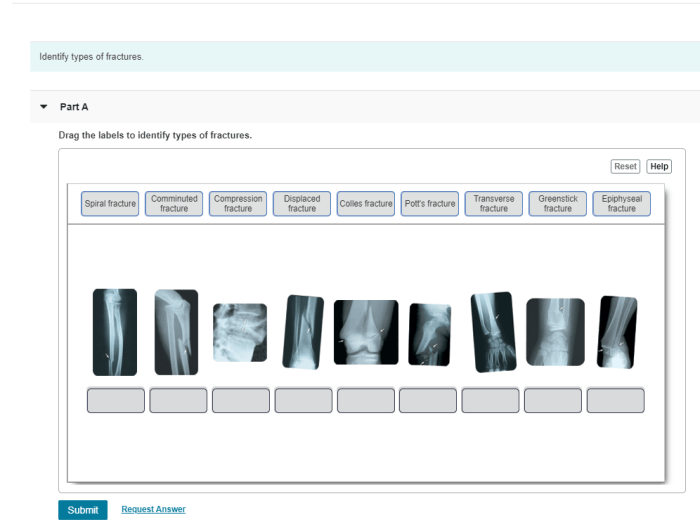 Drag the labels to identify types of fractures